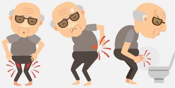 Prostatite symptoms